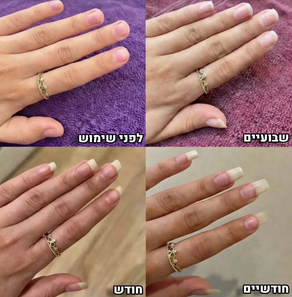 עט השמן של nivelle לשיקום הציפורן והעור