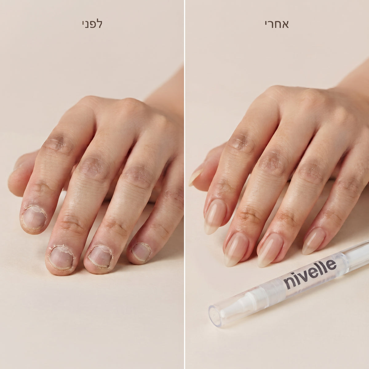 Nivelle Recovery – שמן טיפול ושיקום לציפורניים
